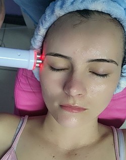 RF facial treatment